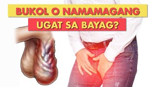 Q amp A BUKOL SA BAYAG NAMAMAGANG UGAT SA BAYAG ATBP [upl. by Aranaj]