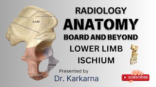 Lower Limb Radiology AnatomyIschial Bone Essential Knowledge  FRCR FRANZCR ABR [upl. by Amos403]