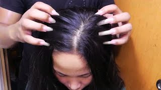 Fast amp Aggressive ASMR Scratch Itchy Scalp So I Did Satisfying Scalp Scratching  No Talking [upl. by Eshelman448]