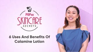 6 Uses And Benefits Of Calamine Lotion  POPxo Skincare Secrets [upl. by Ahtinak]