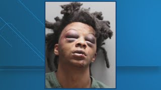 Jacksonville police release report booking photo of man accusing officers of brutality [upl. by Dnaltiak]