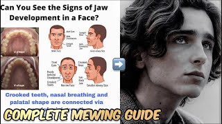 Full Mewing Guide  Hindi  Mewing Kaise Kare [upl. by Gilead533]