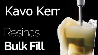 Kavo Kerr  Resinas Bulk Fill [upl. by Risan]