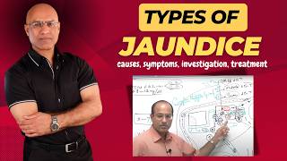 Types Of Jaundice  Causes Symptoms amp Treatment  Dr Najeeb [upl. by Drol]