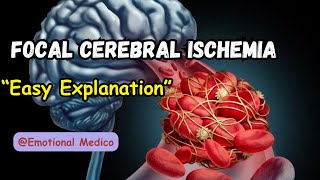 Focal cerebral ischemia  Ischemia and Infarction  CNS pathology  emotionalmedico [upl. by Ynohtnaleahcim]