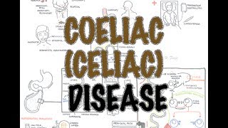 Coeliac Celiac Disease  Overview signs and symptoms pathophysiology diagnosis treatment [upl. by Thorndike]