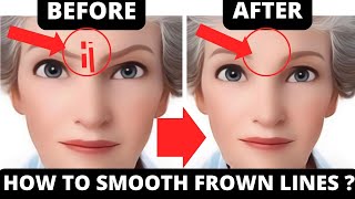 EASY FACIAL EXERCISES TO GET RID OF FROWN LINES WITHOUT BOTOX [upl. by Anoiek]