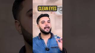 Puffy Eyes Eye Bags amp Dark Circles Treatment Solution for Brighter Eyes [upl. by Artie]