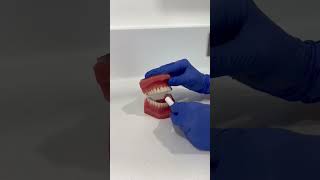 How to use chewies to fit your Invisalign clear aligners [upl. by Lamson]