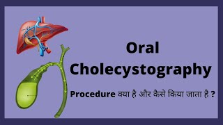 Oral Cholecystography Procedure OCG Radiology [upl. by Corie]