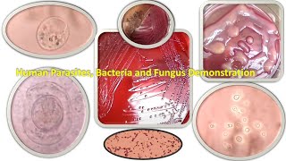 Human Parasites Bacteria and Fungus Demonstration [upl. by Rudd]