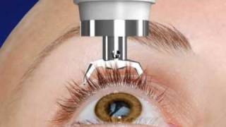 Unique DIATON Tonometry Through Eyelid  with Diaton Tonometer  Introduction  Description Part1 [upl. by Ahsiatal]