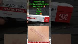 Placentrex Gel use and healthy life healthylifestyle part 2 [upl. by Ramedlaw]