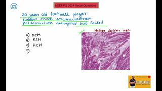NEETPG 2024 Recall  Questions 21 to 30  Dr Shankar Dey [upl. by Ledua]