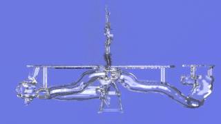 Gonadal Vein Embolization Extension Model [upl. by Algernon]