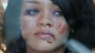 Rihanna Pictures after Chris Brown beat her [upl. by Eamanna]