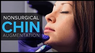 Non Surgical Chin Augmentation With Dermal Fillers at Mabrie Facial Institute [upl. by Dlnaod]