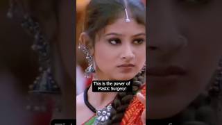 when Mouny Roy Got Trolled For Plastic Surgery shorts mounyroy [upl. by Trefler618]