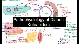 Pathophysiology of Diabetic Ketoacidosis [upl. by Aerdno]