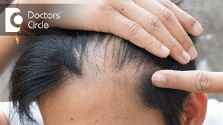 Whan can cause hair loss on temples in teenagers  Dr Aruna Prasad [upl. by Ailiec]