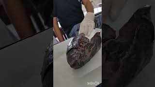 Lungs Dissection Anatomy Lab Msm Khanpurkalan Bams 1st proff Ayurveda [upl. by Kendry]