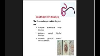 Parasitology  Schistosoma haematobium  by Dr Shimaa Nephrology Module [upl. by Hamlin]