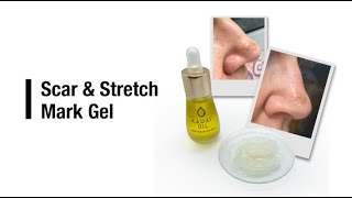 Scar amp Stretch Mark Gel [upl. by Yttel]