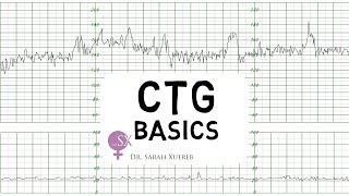 CTG Basics [upl. by Bethesde569]