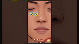 🧡🍁ASMR Face Blackheads And pimples popping Treatment 🌈❤  asmrvideos shorts 3danimation viral [upl. by Ailecra]