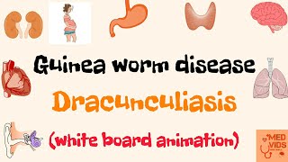 Dracunculus medinensis  Guinea worm  Parasitology  Microbiology  Med Vids Made Simple [upl. by Asseneg]