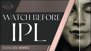 What To Expect  IPL Photofacial  Improve Color amp Texture  Remove Sun Damage [upl. by Abibah]