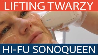 Królowa liftingu czyli bezoperacyjny lifting twarzy technologią HIFU SonoQueen 脸部提升 [upl. by Bass]