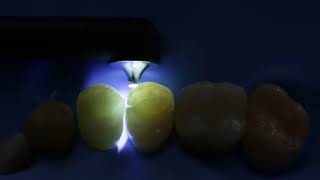 Keys to Light Curing with the SmartLite Pro  A look at Beam Profil I Dentsply Sirona [upl. by Evyn]