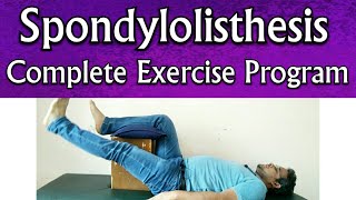 Spondylolisthesis EXERCISES  Effective Exercises For Spondylolisthesis TREATMENT At Home Naturally [upl. by Eimot694]