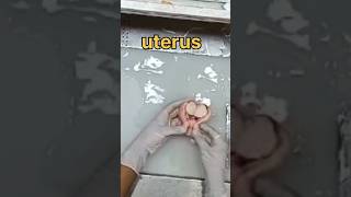 Uterus specimen grossing 🧐👀 [upl. by Hardner]