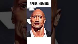 Before and After Mewing Transformation mewing [upl. by Notnirt]