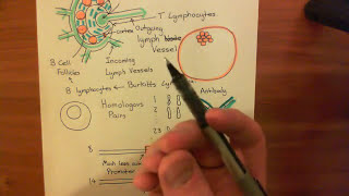 Burkitts Lymphoma Part 2 [upl. by Orsa]