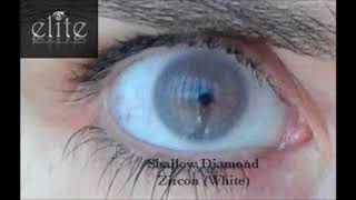 Elite Lenses Zircon [upl. by Enniroc475]