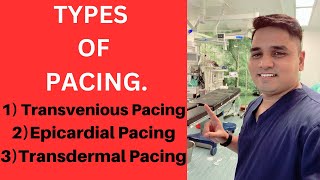 Types Of Pacing Transvenious PacingEpicardial PacingTransdermal Pacing [upl. by Nadoj]