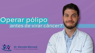 Operar pólipo de intestino de forma preventiva Assista até o final [upl. by Ailongam]