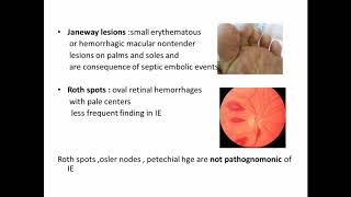 Infective endocarditisdiagnosismodified dukes criteria [upl. by Marvel]