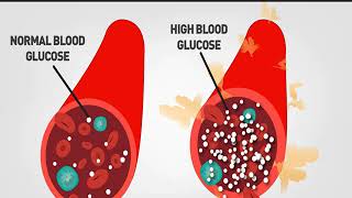 Zinc oxide nanoparticles A possible treatment for diabetes [upl. by Mitzl]