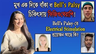 মুখ এক দিকে বাঁকা বা Bells Palsy চিকিৎসায় ফিজিওথেরাপি । Electrical Stimulatiom প্রয়োজন আছে কী [upl. by Reis]