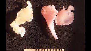 Pork tapeworm and cysticercosis [upl. by Haleigh]