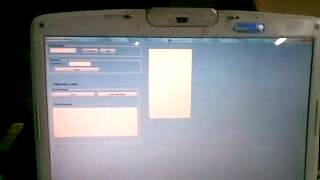 Arduino based Blood GlucometerPart1mp4 [upl. by Odille207]