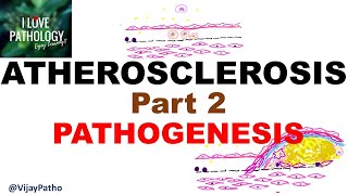 ATHEROSCLEROSIS  Part 2 Pathogenesis [upl. by Hosbein609]