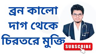 Zonyra Cream ব্রন কালো দাগ থেকে চিরতরে মুক্তি Mohammad Abdullah [upl. by Spiros]