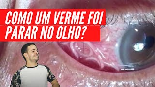 Como um Verme foi parar nos Olhos  Prof Heytor Neco [upl. by Atnek991]