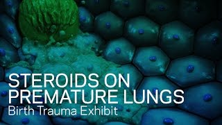 Effects of Steroids on Premature Lungs  Birth Trauma Animation [upl. by Airotnahs]