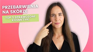 Przebarwienia po trądziku  jak się ich pozbyć 🤯 TOP 3 sprawdzone kosmetyki na przebarwienia ❤️ [upl. by Llenhoj815]